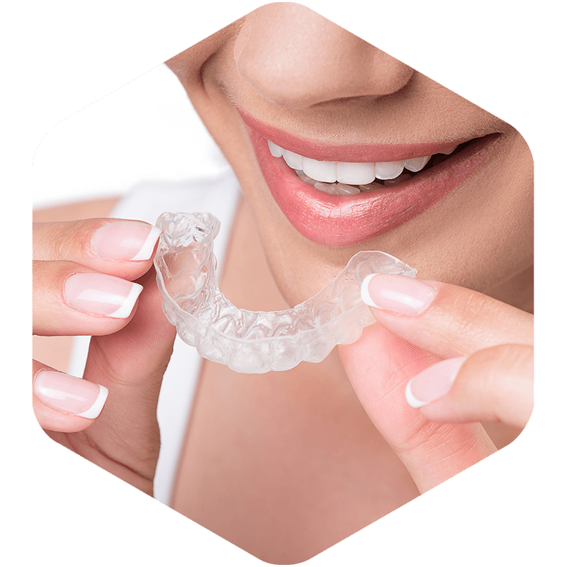 Clear aligners on a patient.